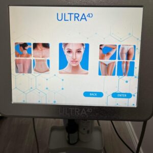 4d hifu before and after